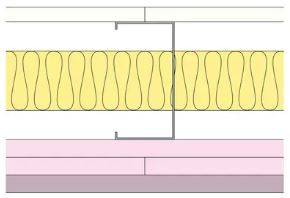 GypLyner Xternal - T106038 MR1 (EN)