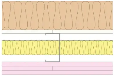 GypLyner Xternal - T106045 (EN)