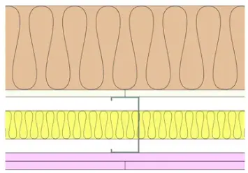 GypLyner Xternal - T106044 (EN)
